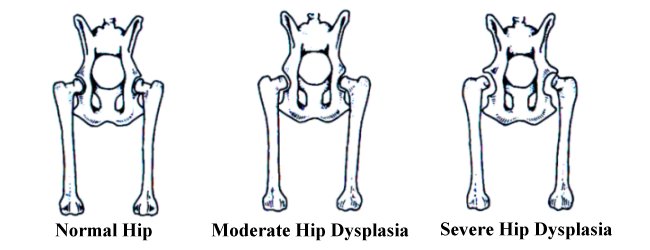 hip dysplasia